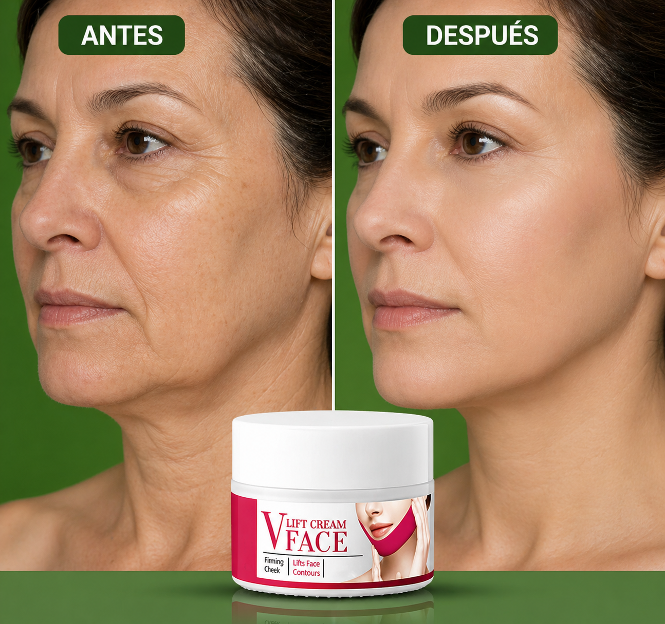 Crema Facial V-Lift – Reafirma, Moldea y Eleva el Contorno Facial